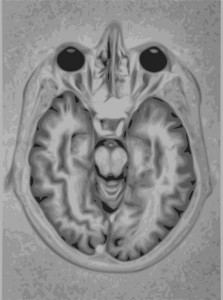 Cerebro explorado con resonancia magnética (fuente Wikipedia)