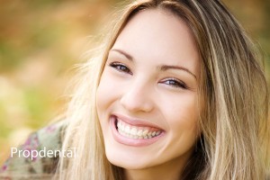Estética dental