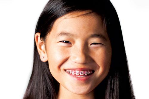 Ortodoncia para niños