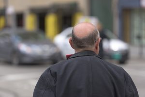 ¿Cuáles son las diferencias entre la técnica FUE y la FUSS (tira)?