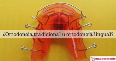ortodoncia lingual o tradicional