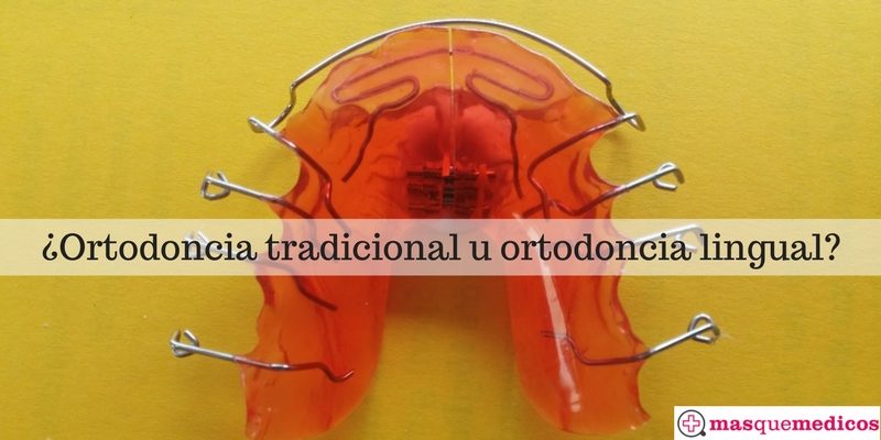 ortodoncia lingual o tradicional