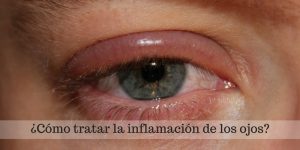 cómo tratar la inflamación de los ojos