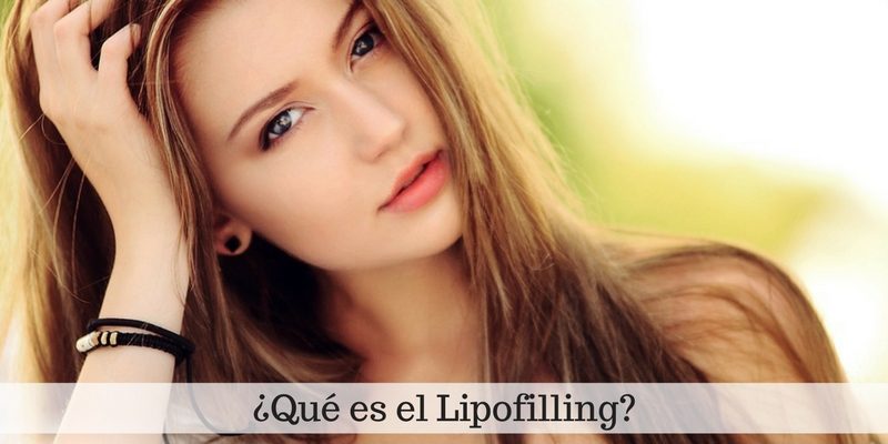 ¿Qué es el Lipofilling?
