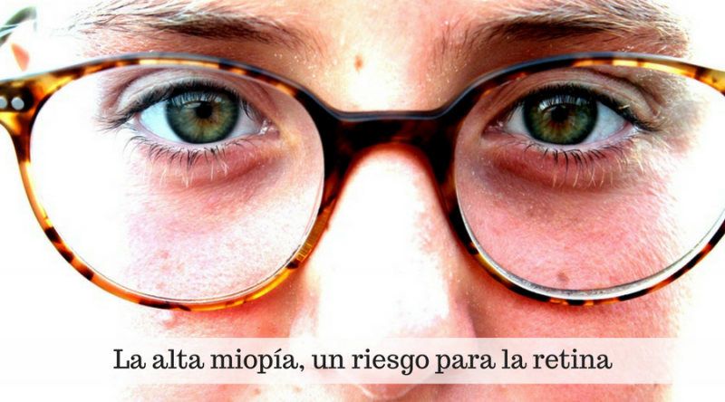 La alta miopía, un riesgo para la retina