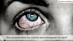 ¿Son perjudiciales los colirios para blanquear los ojos-