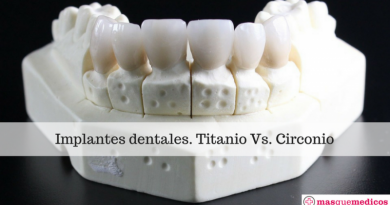 Implantes dentales. Titanio Vs. Circonio