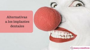 alternativas a los implantes dentales