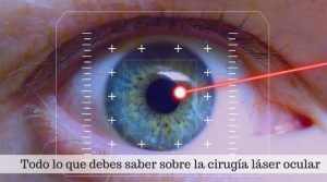 Cirugía láser ocular. Tasas de éxito