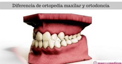 Cuál es la diferencia de ortopedia maxilar y ortodoncia