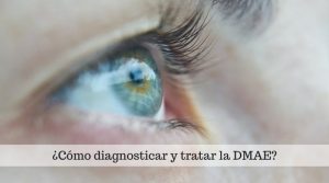 ¿Cómo diagnosticar y tratar la Degeneración Macular Asociada a la Edad?