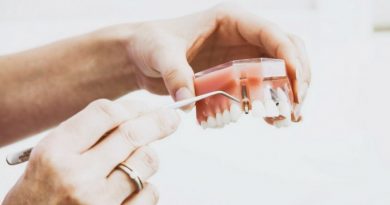 implantes dentales caredent