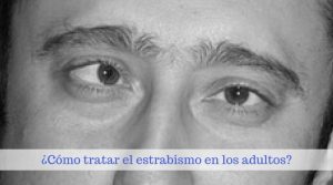 estrabismo en adultos