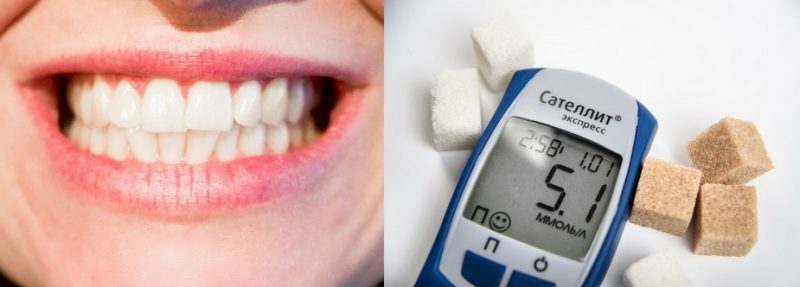 diabetes y periodontitis