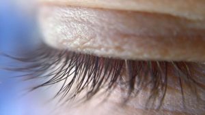 ¿Cuáles son las anomalías que corrige la cirugía oculoplástica?