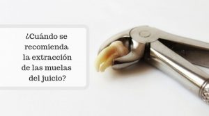 ¿Cuándo se recomienda la extracción de las muelas del juicio?