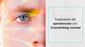 Tratamiento del queratocono con Crosslinking corneal