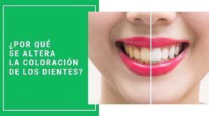 ¿Por qué se altera la coloración de los dientes?
