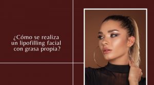¿Cómo se realiza un lipofilling facial con grasa propia?