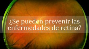 ¿Se pueden prevenir las enfermedades de retina?