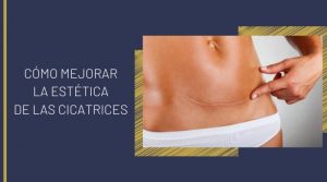 Cómo mejorar la estética de las cicatrices