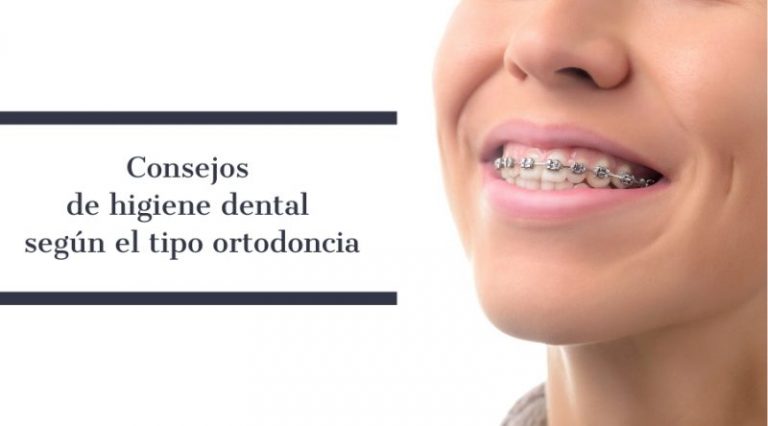 Consejos De Higiene Dental Según El Tipo Ortodoncia - Blog MQM