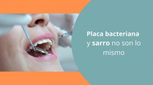 Placa bacteriana y sarro no son lo mismo