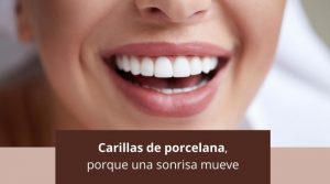 Carillas de porcelana, porque una sonrisa mueve