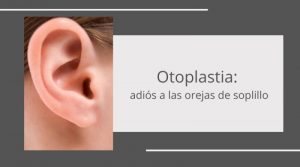 Corrección de orejas de soplillo mediante otoplastia
