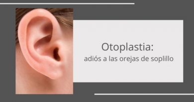 Corrección de orejas de soplillo mediante otoplastia