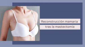Reconstrucción mamaria tras la mastectomía