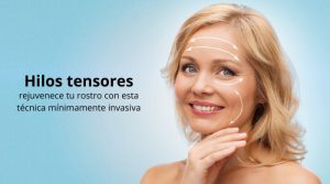 Hilos tensores: rejuvenece tu rostro con esta técnica mínimamente invasiva