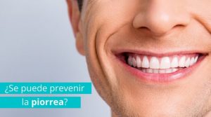 ¿Se puede prevenir la piorrea dental?