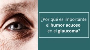 ¿Por qué es importante el humor acuoso en el glaucoma?