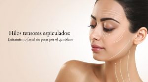 Hilos tensores espiculados