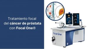 Tratamiento focal del cáncer de próstata con Focal One®