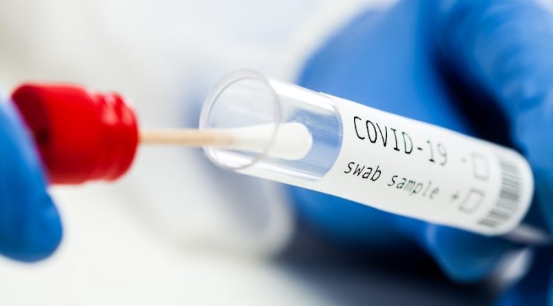 Test de esputo: detección de la Covid-19 a través de la saliva