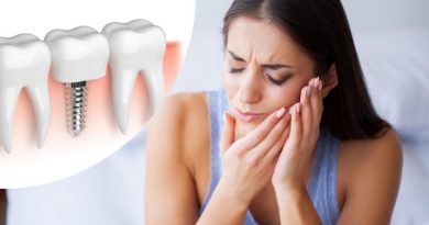 ¿Duele la colocación de los implantes dentales?