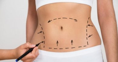 ¿Cómo es la recuperación de una cirugía de abdomen o abdominoplastia?