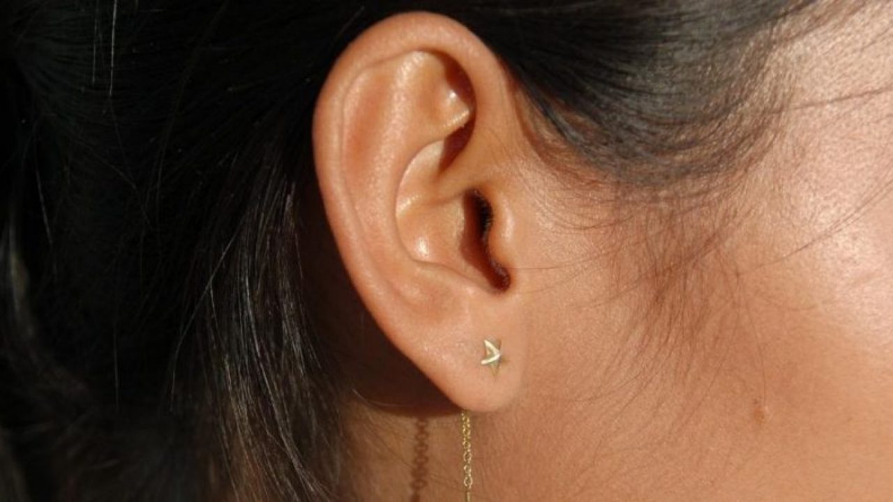Es posible cerrar el agujero del lóbulo de la oreja con cirugía?