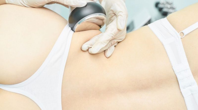 lipo