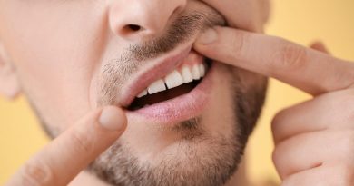 ¿Cómo evitar la gingivitis?