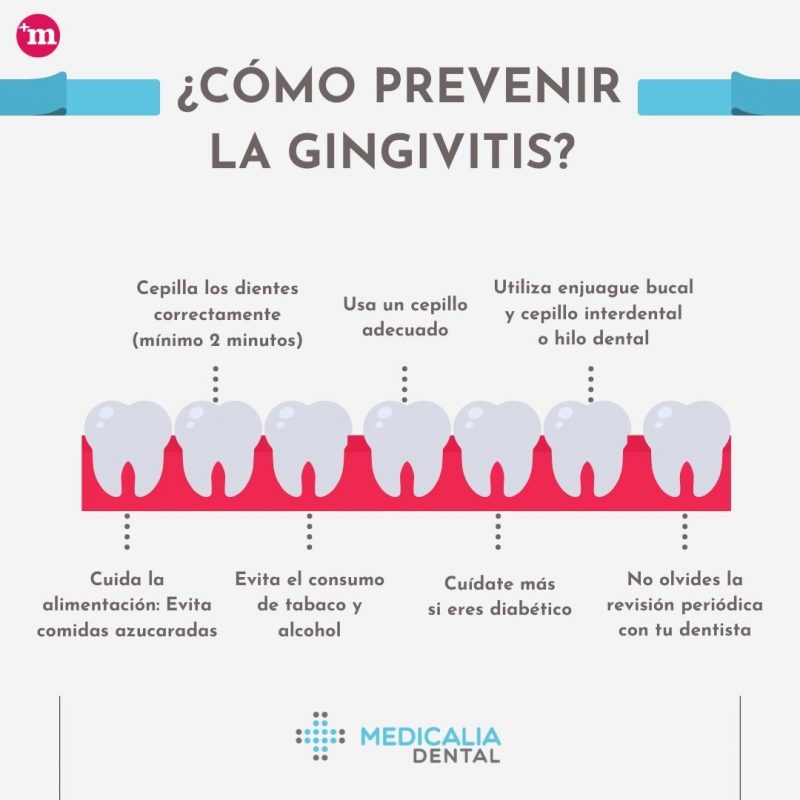 prevenir la gingivitis