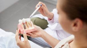 7 consejos para evitar que fracasen los implantes dentales