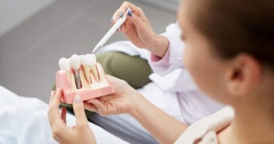 7 consejos para evitar que fracasen los implantes dentales