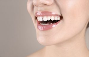 ¿Cómo corregir el diastema con ortodoncia?