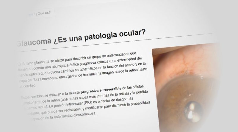 Glaucoma Oftalvist