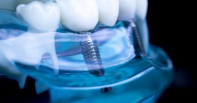 Osteointegración implantes dentales IMOI