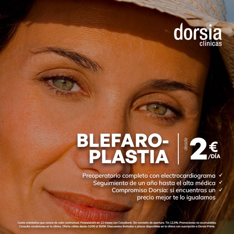 Blefaroplastia - Dorsia