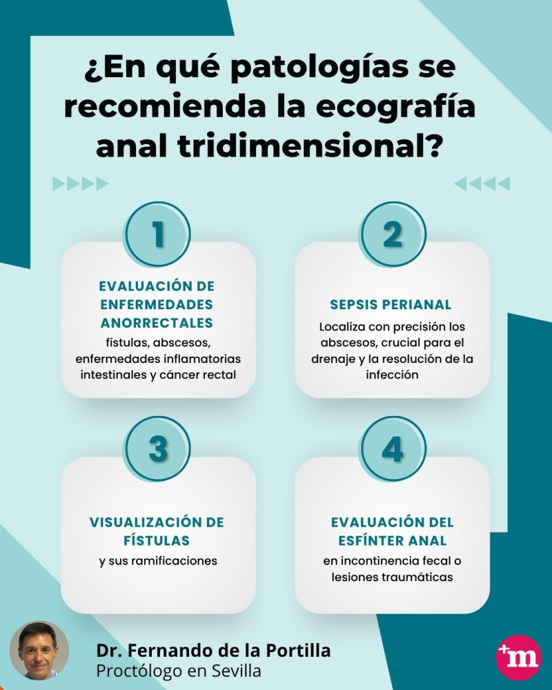 ¿En qué patologías se recomienda la ecografía anal tridimensional?